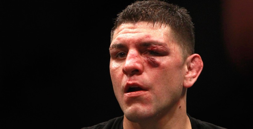Ник Диас отказался от боя с Лоулером - MMA