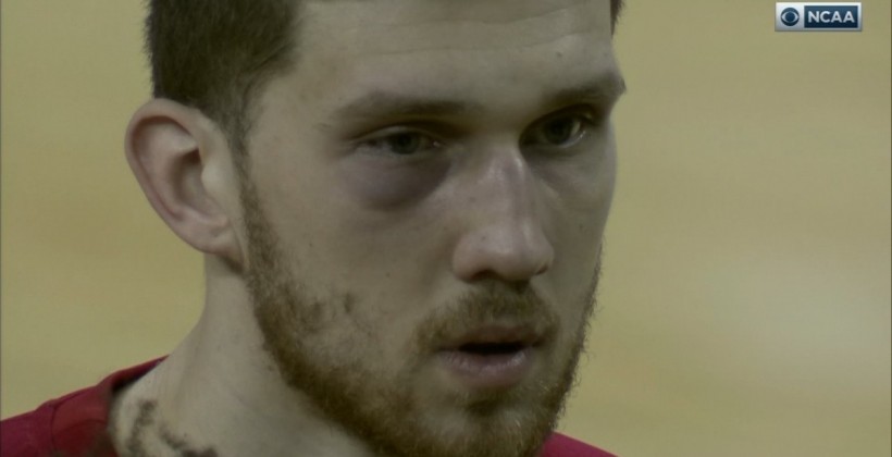 Михайлюк получил повреждение глаза и набрал только 2 очка в матче NCAA - Другие страны
