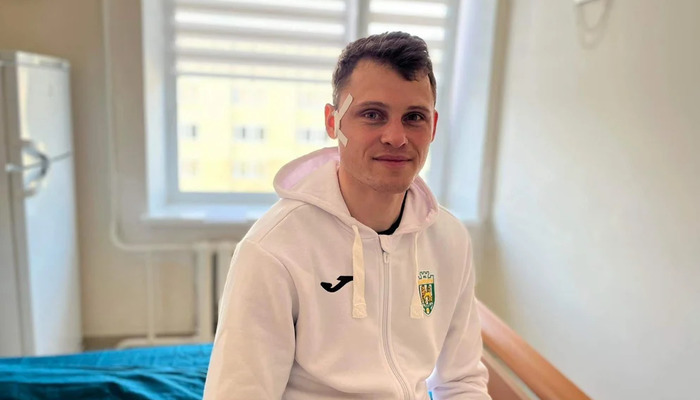 Вратарь Карпат Ильющенков травмировал скуловую дугу - Первая лига Украины